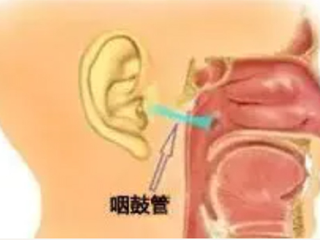 全國愛耳日 專家談急性化膿性中耳炎