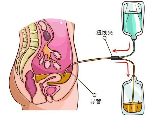 優(yōu)勢學科｜腎臟替代治療——醫(yī) 護 患一體化腹膜透析管理模式